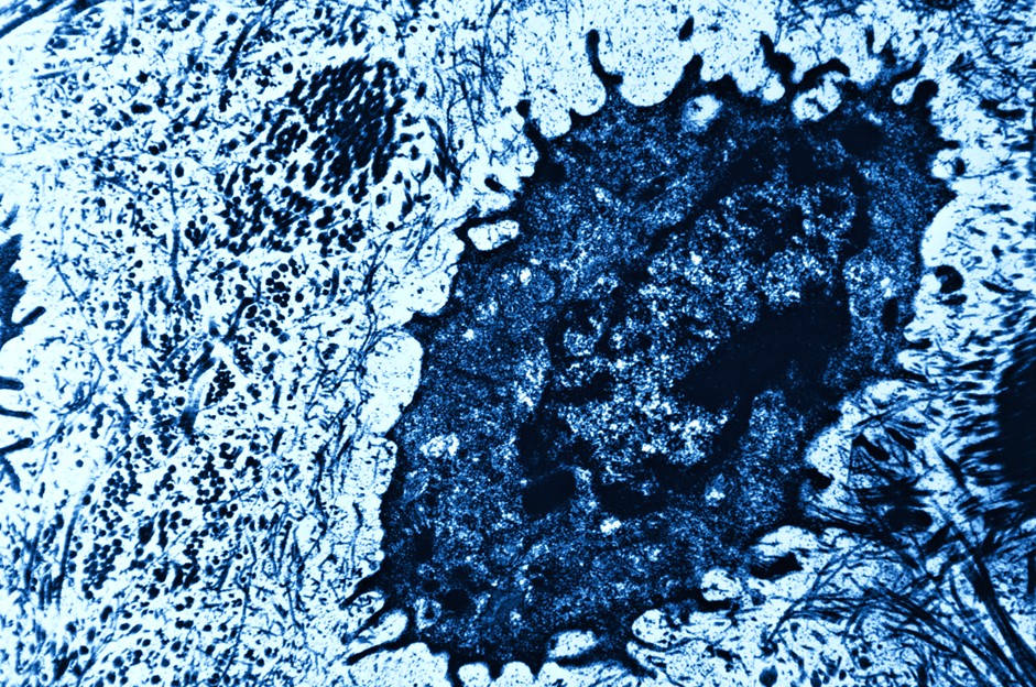 Bone cell 2