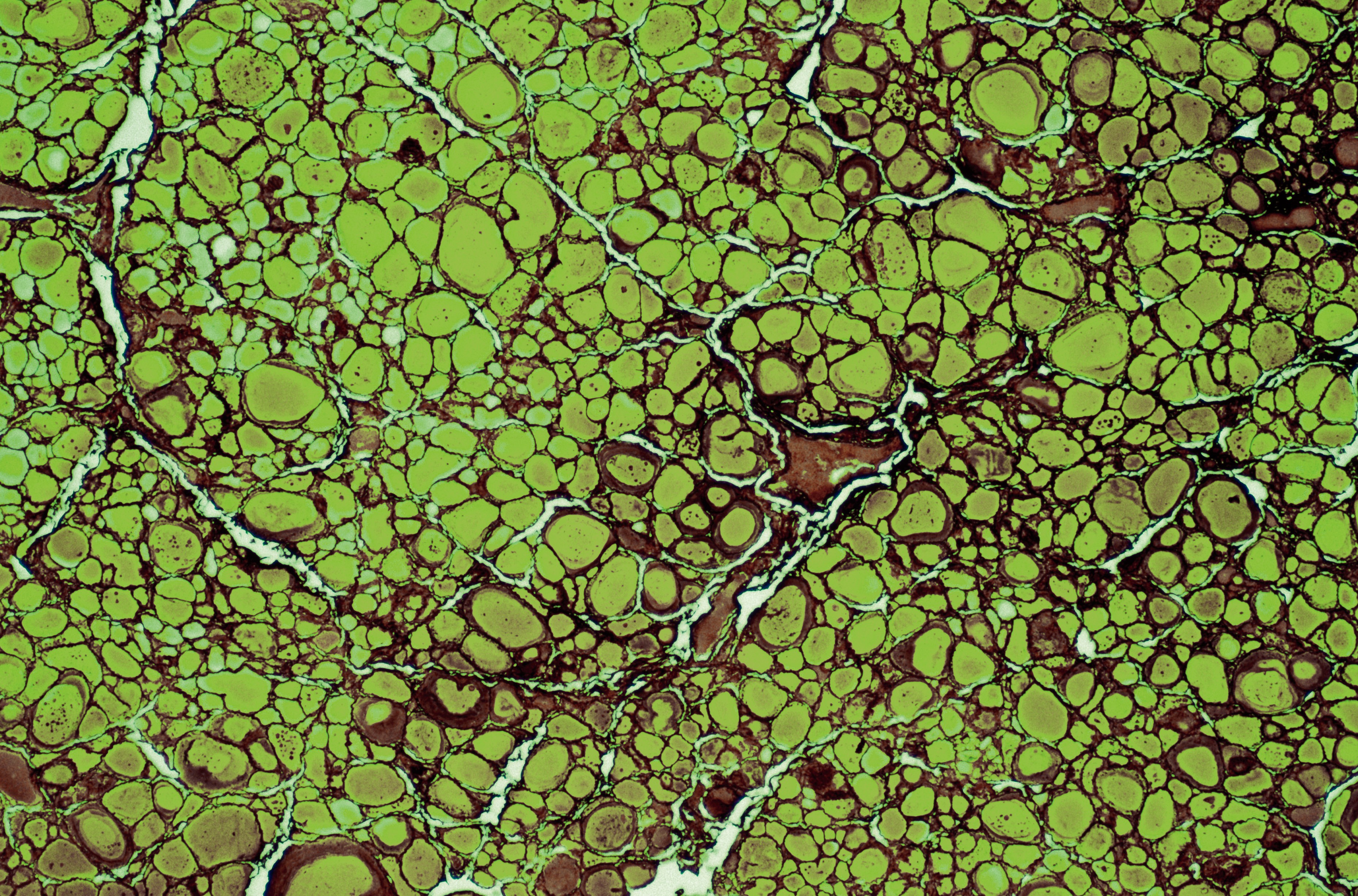 Human thyroid