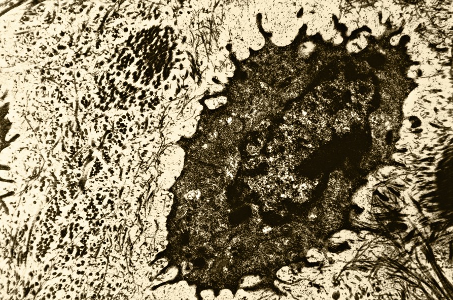 Bone cell