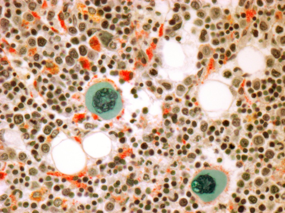 Bone marrow. Cells produce platelets.