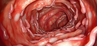 digestive tube