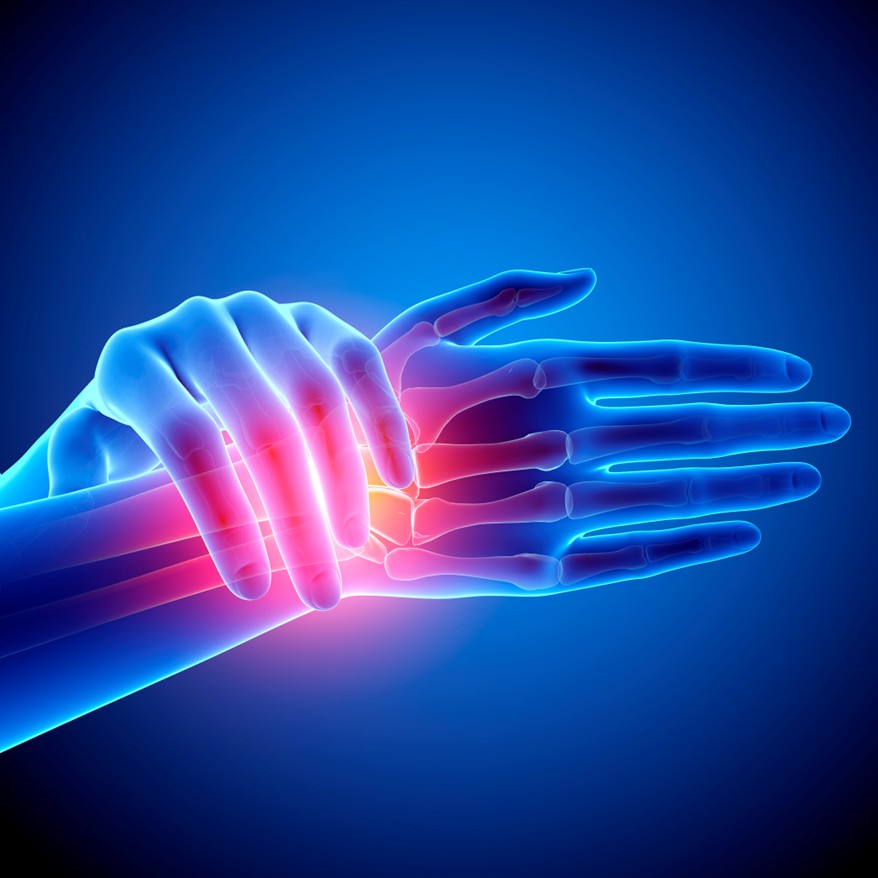 Hand inflammation