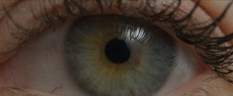Uveitis
